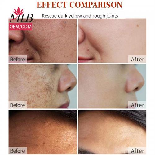 Dark Spot Remover Cream