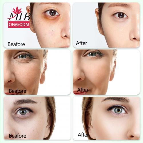 Skailie Aloe Vera Collagen Eye Mask